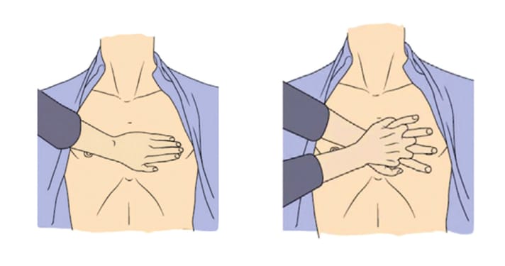 FIGURE 2: Cardiac massage