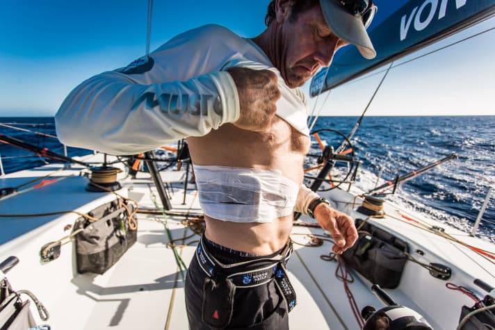   Tony Rae's rib injury