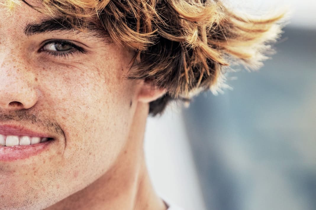 World CupÜberraschung Baptiste Cloarec Der Captain von Cloudbreak