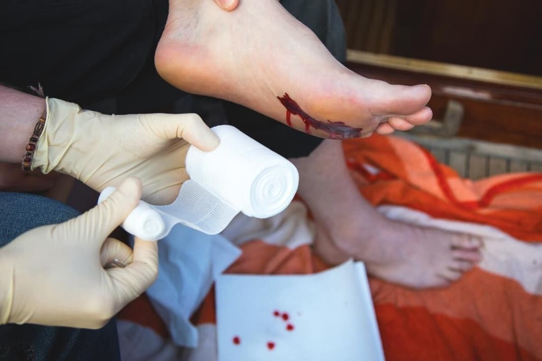 Stop the bleeding with a compress