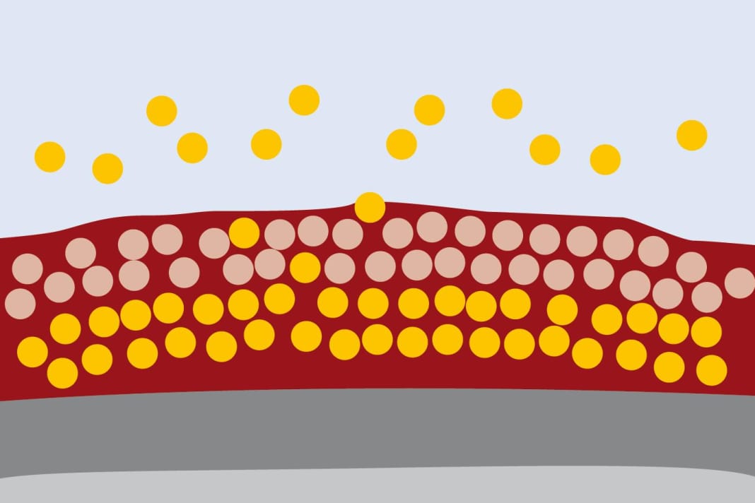 Hard antifouling: The biocides are bound in a resin system. It is mechanically very resilient and is suitable for trailer boats and in tidal areas. Over the course of the season, the active substances wash out and the protection slowly wears off. The empty resin matrix remains on the hull and must be sanded off in winter