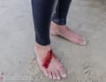 Battle scars