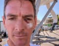 "GB1"-Skipper Dylan Fletcher mit blauem Auge nach der Kollision zwischen den Briten und einem Rib vom Tudor Team Alinghi.