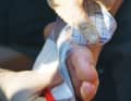 Once the bleeding has stopped, clean and disinfect the wound. Then cover with a wound dressing. If it is at risk of infection, an aluminium-coated dressing is suitable. This also applies to burns