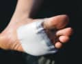 Do not apply the bandage too tightly, check the blood circulation frequently