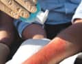 If the wound is heavily soiled and there is an increased risk of infection, additionally disinfect the wound with a non-alcoholic solution. If necessary, alcohol-based