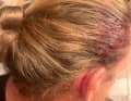 Head injury to Christian Sauer