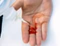 First clean an open wound with sterile water