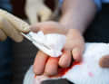 Clean the wound again carefully and then stop the bleeding with a compress