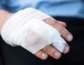 Selon la taille de la blessure, protéger la plaie des impuretés à l'aide d'un pansement ou d'un bandage léger composé de gaze et d'une bande de gaze.