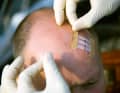 Fix the wound in the compressed position with plaster strips. If these do not stick well, apply additional tape or plasters to the ends