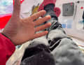 This is what Sam Davies' hands look like after almost 40 days at sea.