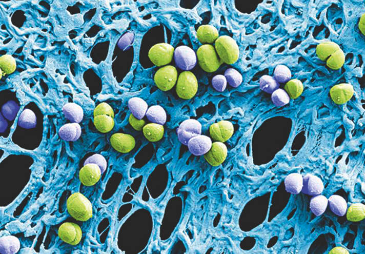   Erst unter dem Mikroskop werden Mikrokokken, wie Dieselbakterien, und spezielle Hefepilzgattungen, wie Rhodotorula, deutlich sichtbar