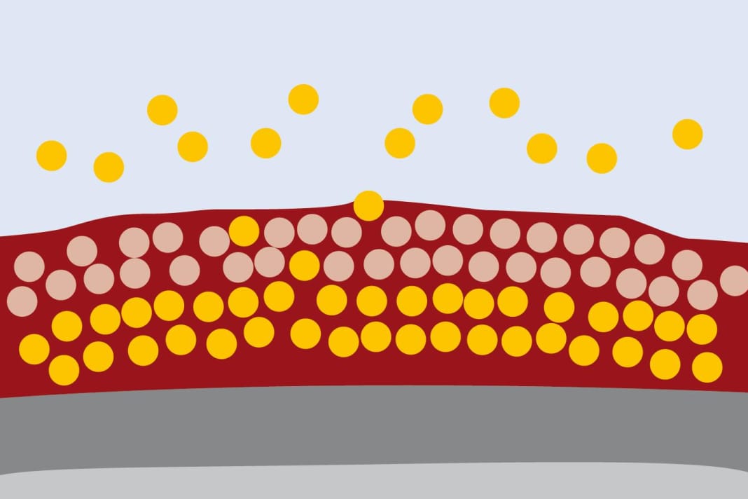 Hard antifouling: The biocides are bound in a resin system. It is mechanically very resilient and is suitable for trailer boats and in tidal areas. Over the course of the season, the active substances wash out and the protection slowly wears off. The empty resin matrix remains on the hull and must be sanded off in winter