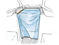 Simple protection: As soon as the summer day draws to a close, the mosquitoes, the little pests, arrive. Whilst windows and hatches can be well protected from the bloodsuckers, the companionway is a real flyway. We have found a remedy with a piece of curtain fabric, two wooden strips matching the length of the sliding hatch guide and a bit of lead cord. The wooden strips are simply stapled to the curtain and hooked behind the guide rails of the sliding hatch on both sides. The lead cord at the bottom hem holds the grille in place.  Diana Mehl, Jüchen