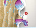 More and more laminate is decomposed, better the resin in the laminate. What remains are fibres without cohesion