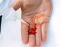 First clean an open wound with sterile water