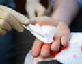 Clean the wound again carefully and then stop the bleeding with a compress