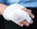 Selon la taille de la blessure, protéger la plaie des impuretés à l'aide d'un pansement ou d'un léger bandage compressif composé de gaze et d'une bande de gaze.