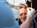 First clean the wound as described under "Cuts".