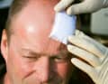 Cover the wound with a compress and plasters. If a concussion is suspected, go to the doctor on land
