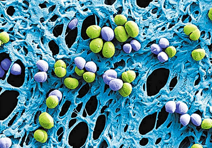   Erst unter dem Mikroskop werden Mikrokokken, wie Dieselbakterien, und spezielle Hefepilzgattungen, wie Rhodotorula, deutlich sichtbar