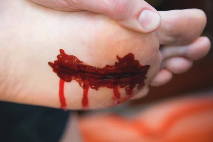   Schon eine kleine Scherbe oder scharfkantige Steine können tiefe Schnitte verursachen. Nur Schuhe bieten ausreichend Schutz