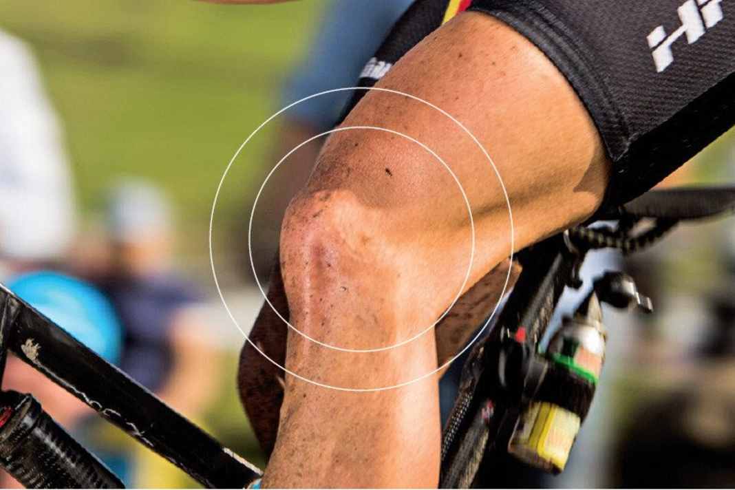 Knieschmerzen beim Radfahren verhindern
