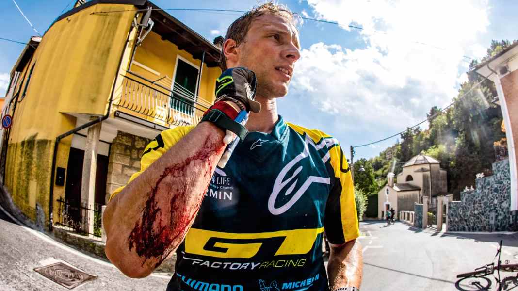 Pro & Contra: Brauche ich Ellbogenschoner beim Biken?