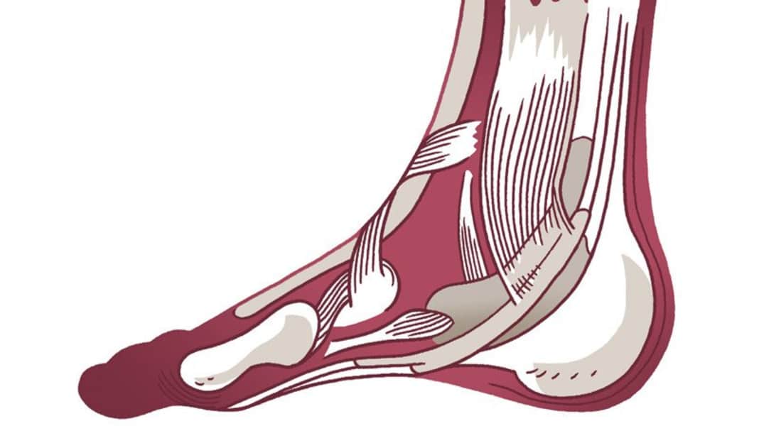 Training against foot complaints