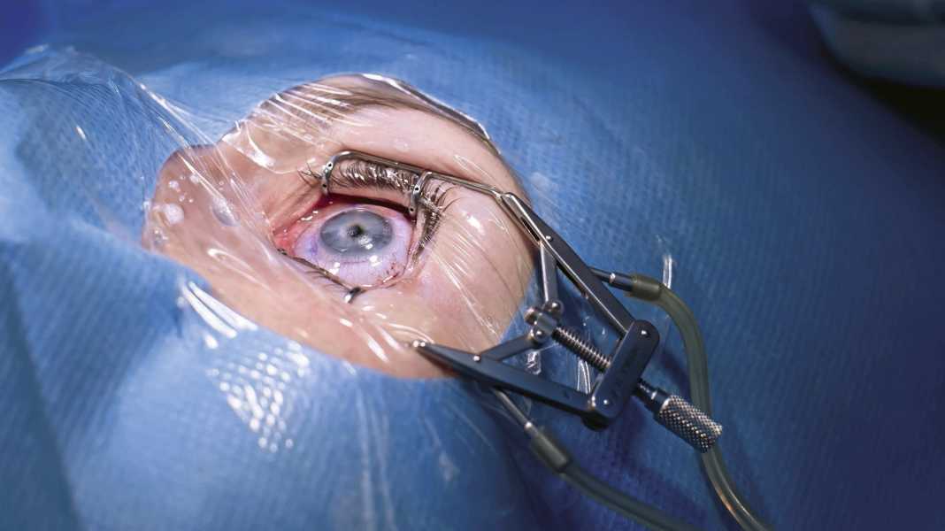 See well when cycling: Is laser eye surgery worth it?