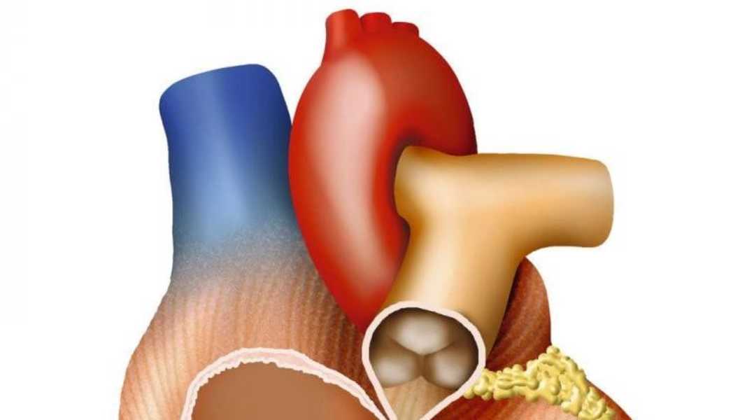 Rennradfahren trotz Herzkrankheit - Kardiologe Dr. Thomas Kaspar im TOUR-Interview