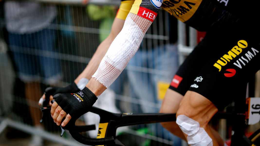 Erste Hilfe bei Schürfwunden - Die richtige Wundversorgung von Schürfwunden