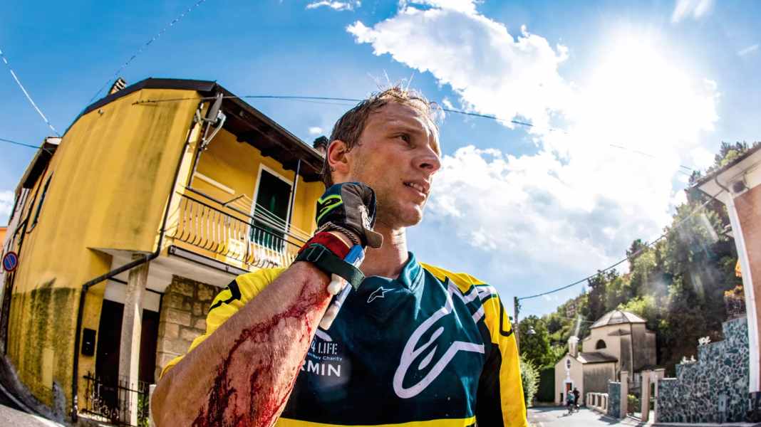 Pro & Contra: Brauche ich Ellbogenschoner beim Biken?