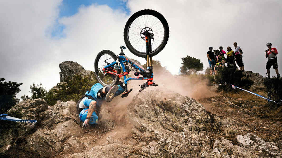 Schädel-Hirn-Trauma: Symptome, Folgen und eine neue Diagnostik-Methode