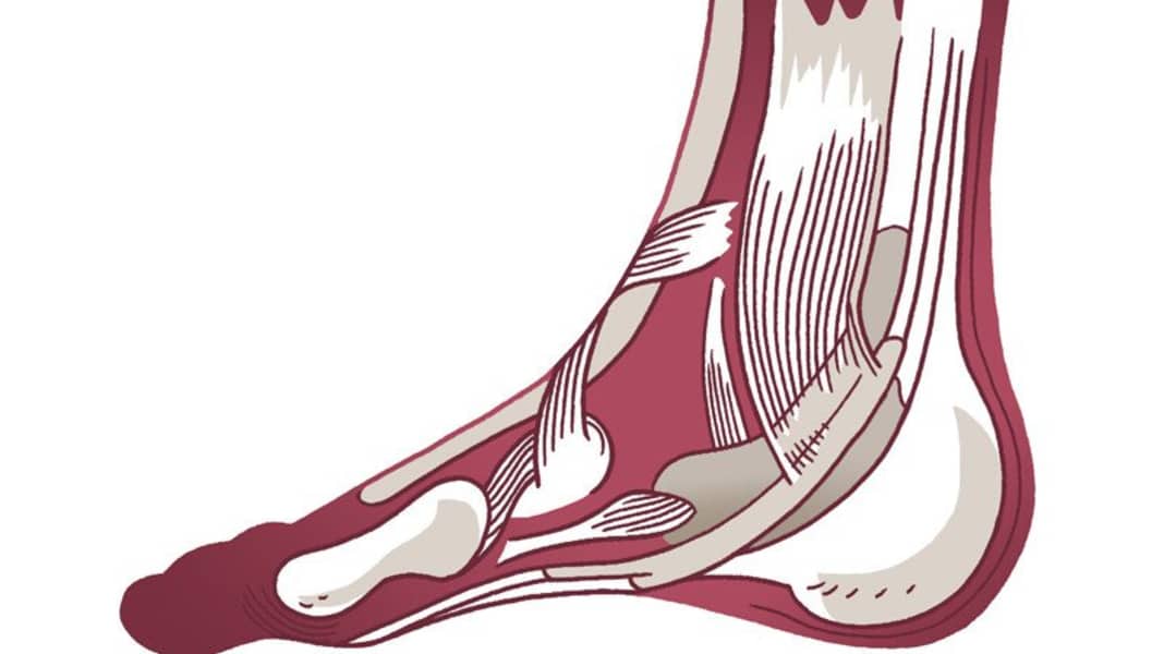 Training gegen Fußbeschwerden