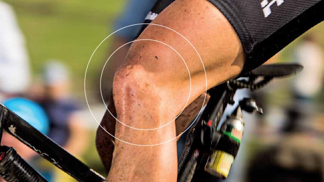 RATGEBER: Knieschmerzen beim Radfahren verhindern