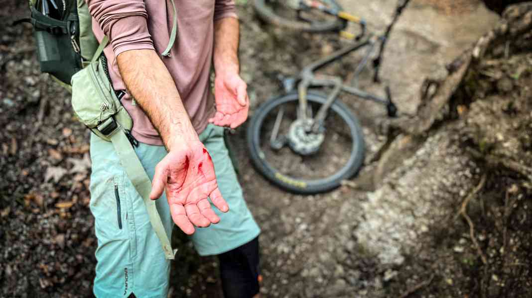 Handschuhe beim Mountainbiken: Warum ich nie mehr ohne auf den Trail gehe