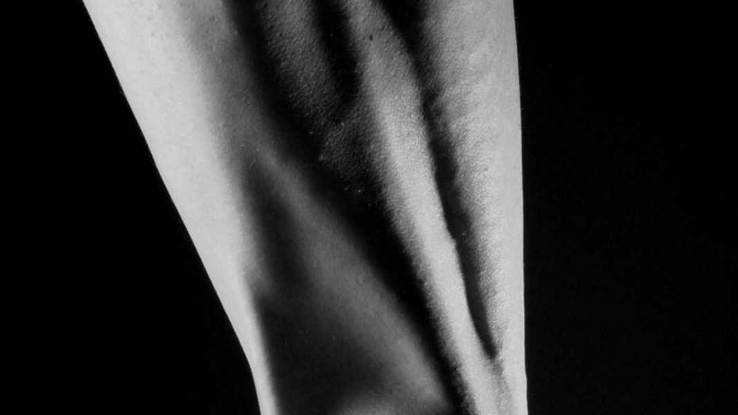Tendon rupture