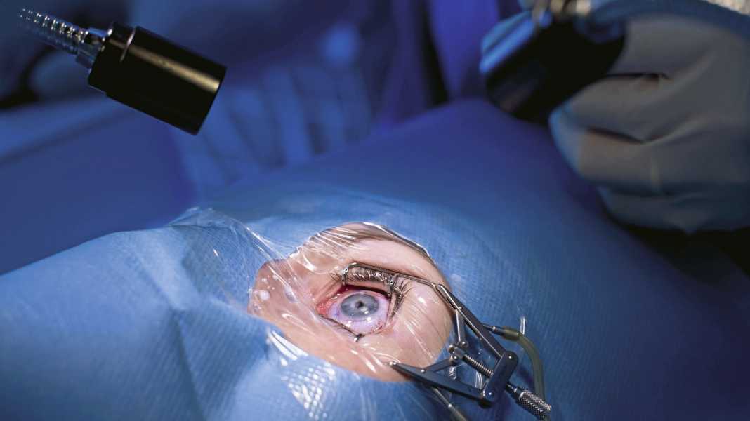 See well when cycling: Is laser eye surgery worth it?