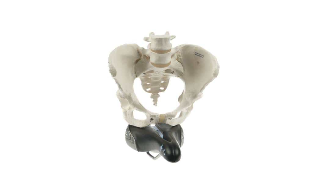 Recovery training after a femoral neck fracture