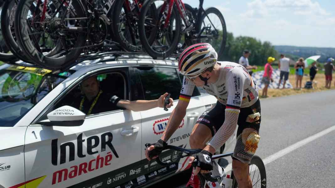 Tour de France - Keine Knochenbrüche bei Zimmermann - Ellenbogen schmerzt
