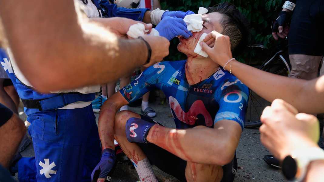 Frankreich-Rundfahrt - Mit 20 Stichen genäht: Rubio gibt Tour nach Auto-Crash auf