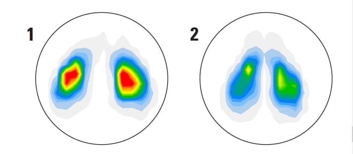 How to read the measurement images: The white area shows the measuring points under load. The stronger the individual colours range from white, grey, blue, green to yellow and red, the greater the load. Heavy loads are not necessarily bad. SQlab (1), for example, deliberately concentrates the load of the 611 Ergowave Active on the sit bones and thus relieves the pubic bone and perineal area, while the load of the Selle SMP (2) is distributed more evenly in order to avoid load peaks and thus create comfort. However, a greater load in the perineal area and on the ischial branches can lead to numbness or even hypoxia of the genitals.