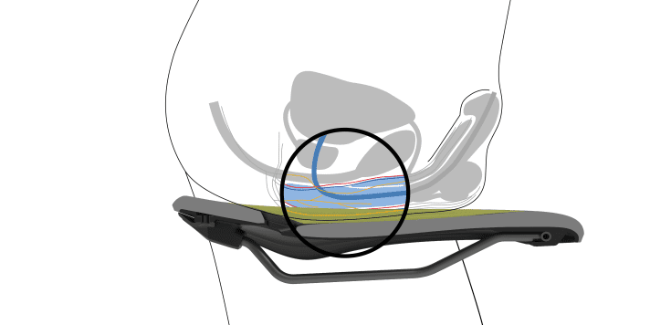 The soft tissue - and especially the genitals - are located differently in men...