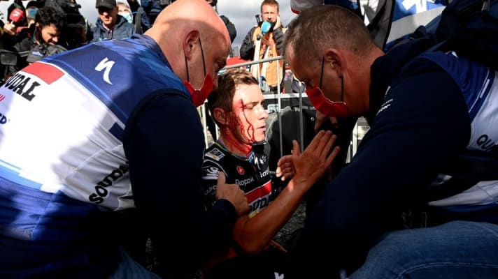 Blutüberströmter Evenepoel: Der Belgier kollidiert nach seinem Sieg auf der 3. Etappe der Vuelta a Espana im Ziel mit einer Frau und erleidet eine Platzwunde über dem rechten Auge. Vuelta a Espana, 3. Etappe, 28. August 2023