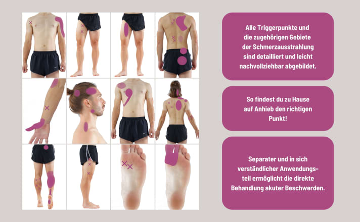 Hättet ihr es gewusst? Die Gebiete, in die der Schmerz ausstrahlt und der verantwortliche Triggerpunkt sind oft ganz unterschiedlich lokalisiert.