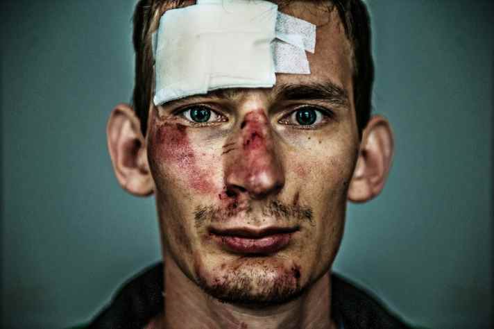 In Bavaria, there were more cyclists killed in road traffic in 2024, but also fewer injured.