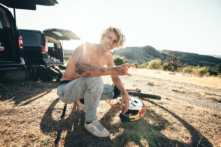 Some of his stunts in the new YouTube video "Video Game" go wrong: From burst lips to a flat nose, everything is included.