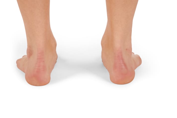    Füße nach außen drücken, Teil 1:  Stellen Sie sich barfuß auf den Boden. Lassen Sie die Füße nach innen fallen (die Knie wandern leicht zueinander).